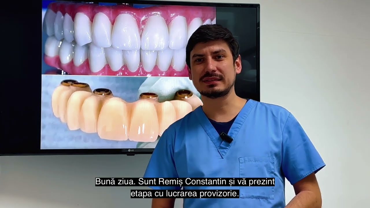 Lucrarea provizorie pe implanturi. Cum arata? Cu gingie falsa sau fara gingie falsa?
