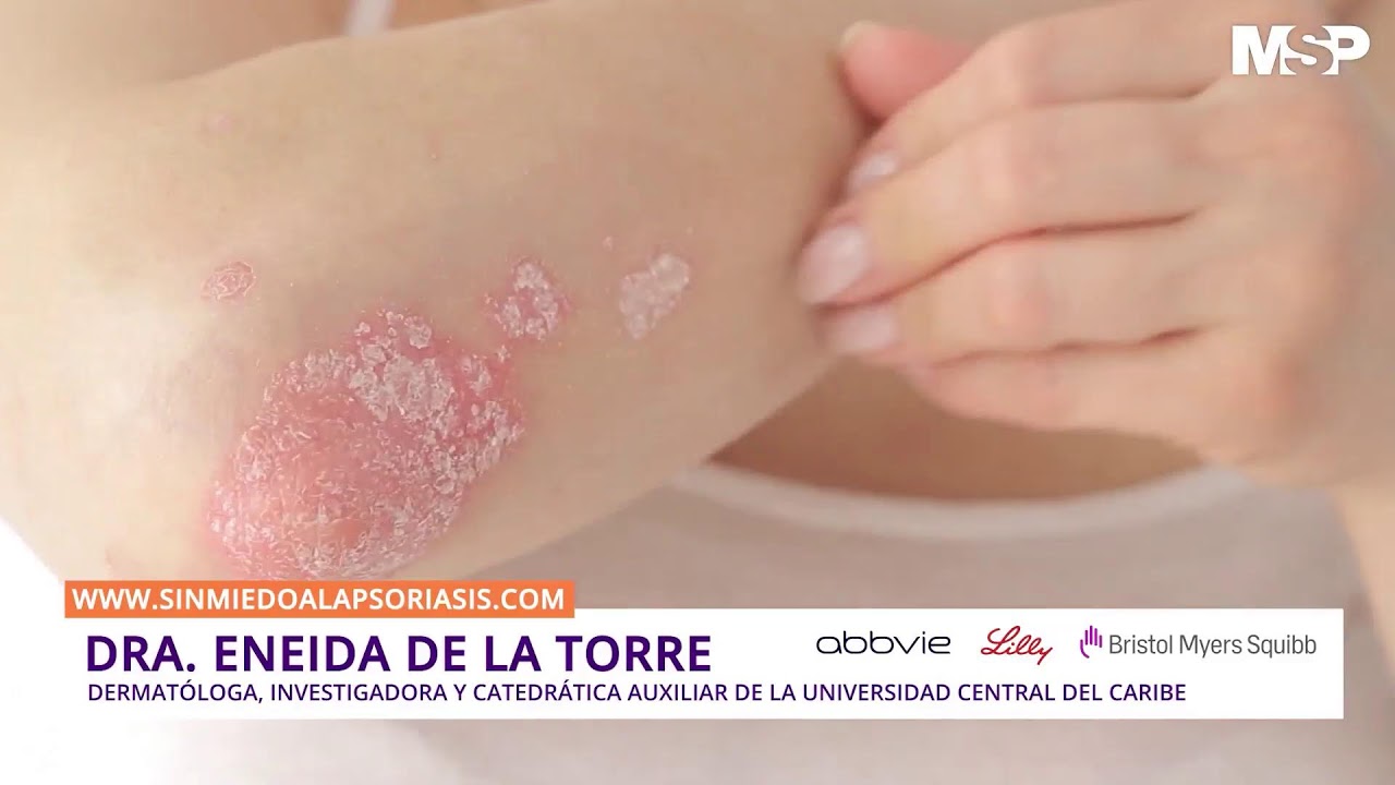 Enfermedades crónicas como la diabetes y sus manifestaciones en la piel - #ExpertosEnSalud