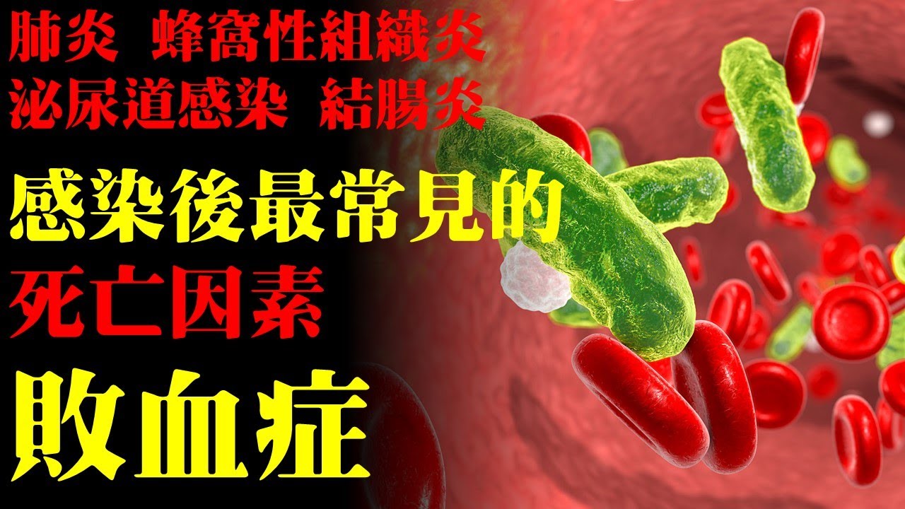 感染後最常見的死亡因素，為何會導致敗血症｜許原彰醫師