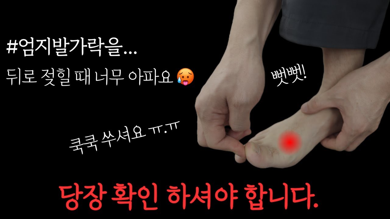 이 증상 무시하면 엄지발가락 통증으로 걷거나 뛸수 없습니다. (지금 당장 엄지발가락 확인하세요📌)