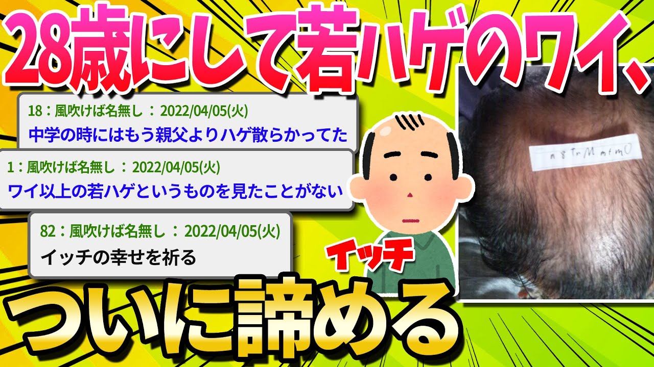 【2ch面白いスレ】ワイ20代若ハゲ、とうとう諦める【ゆっくり解説】