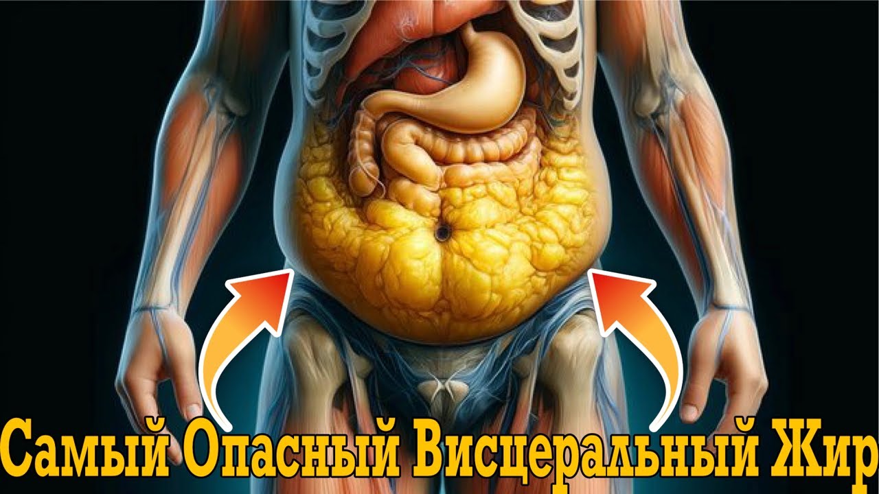 Убираем самый опасный висцеральный жир!