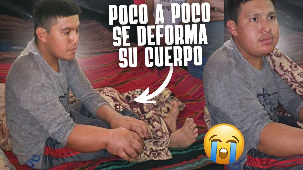 LA CONDICIÓN DE DON BRANDON EMPEORÓ😨 su cuerpo no responde y SE ESTA HINCHANDO SIN CONTROL😱😨