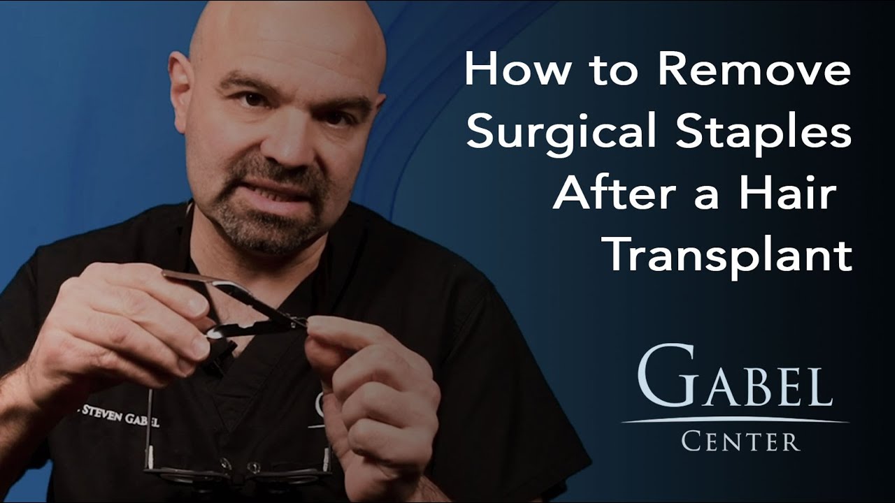 Remove Surgical Staples | Post Hair Transplant | Gabel Center