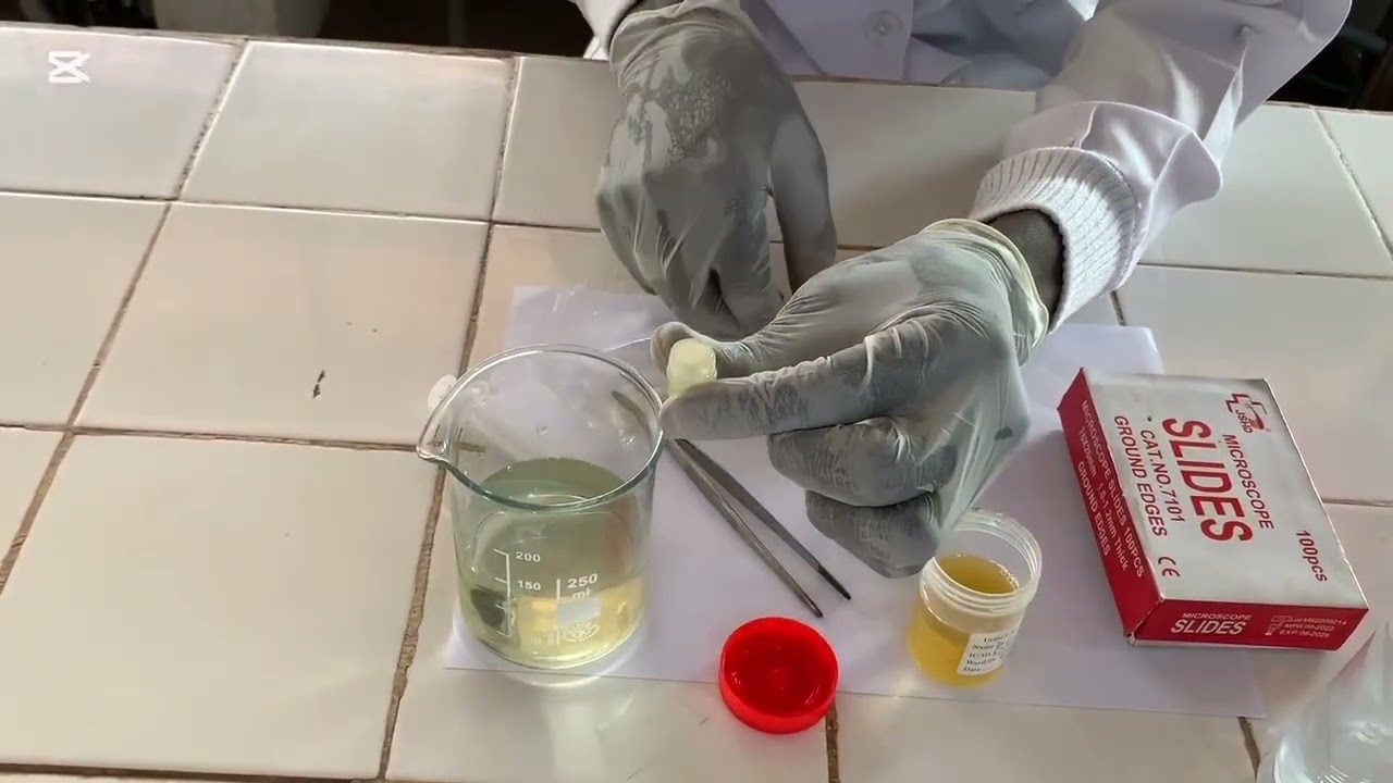 Technique de filtration et de quantification des œufs de schistosoma haematobium dans les urines