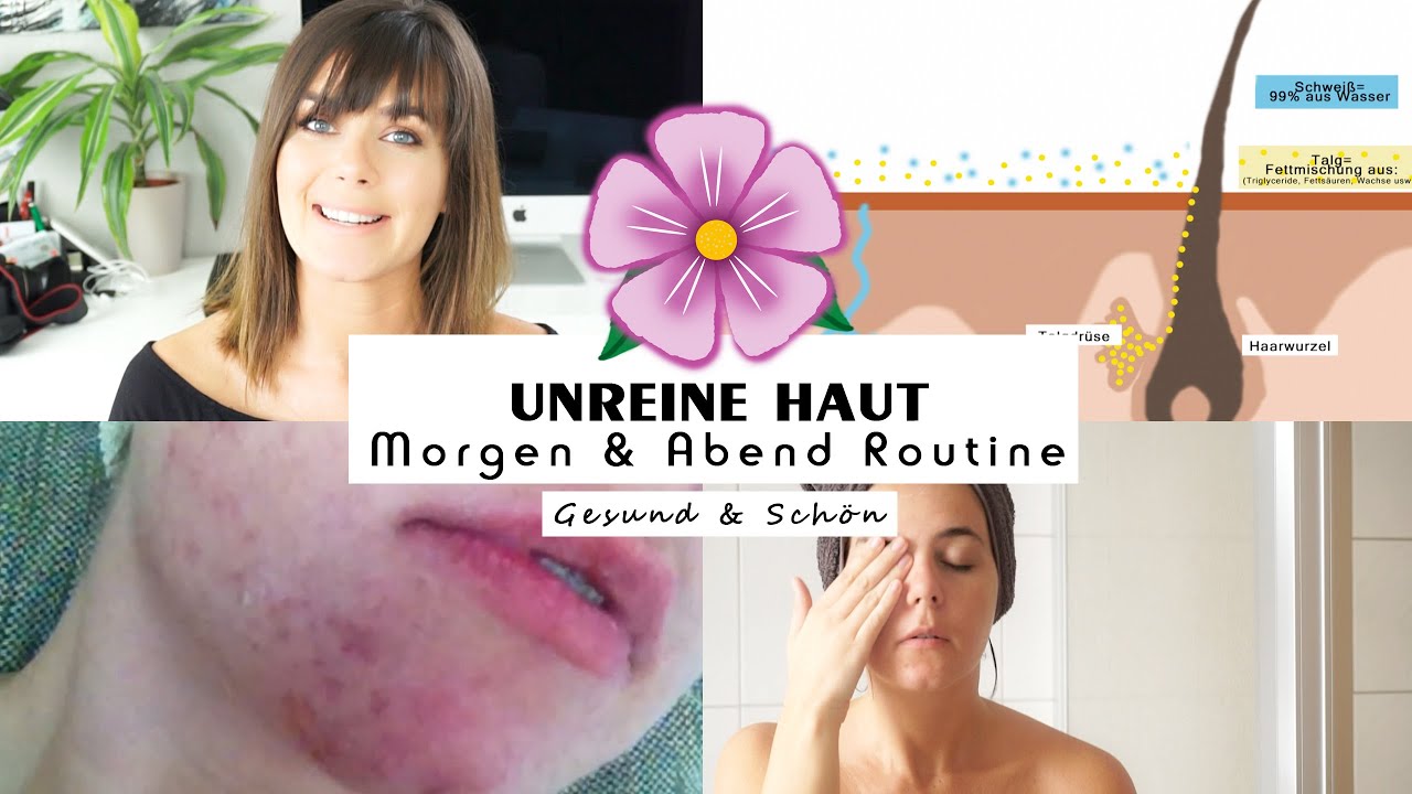 🌸 AKNE BEK&Auml;MPFEN / unreine Haut Mitesser - Gesichtspflege Routine Jucepauline GESUND & SCH&Ouml;N