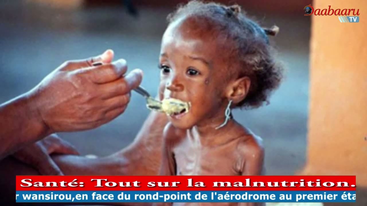 SANTÉ: Tout sur la malnutrition