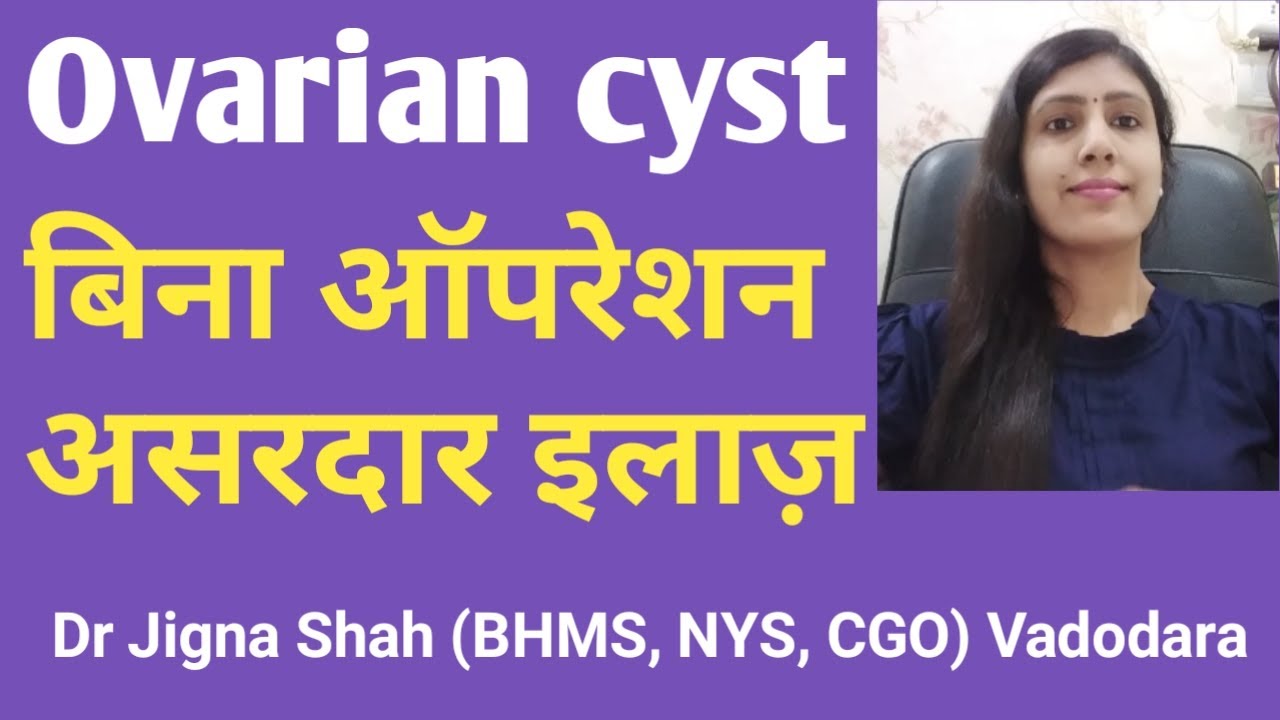 Ovarian cyst# cure#Homoeopathic treatment# without surgery.  Dr Jigna Shah