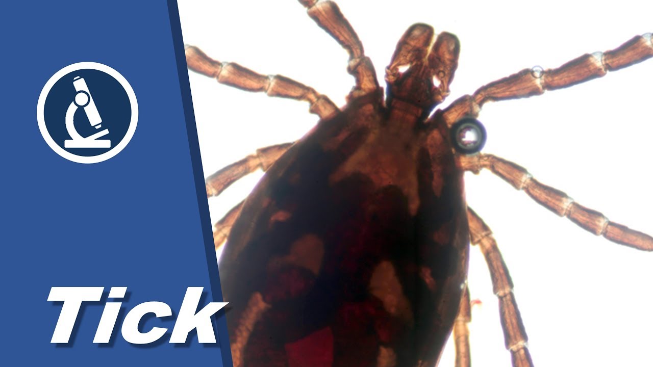 How to look at a LIVE TICK with moving organs under the microscope | Amateur science