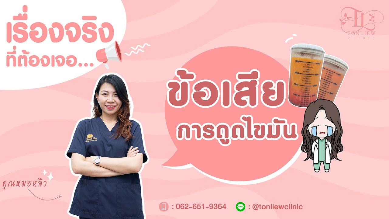 จริงหรือเปล่า? กับข้อเสียของการดูดไขมัน ที่ใครๆเค้าว่ากัน - หมอหลิว ต้นหลิวคลินิก รามอินทรา