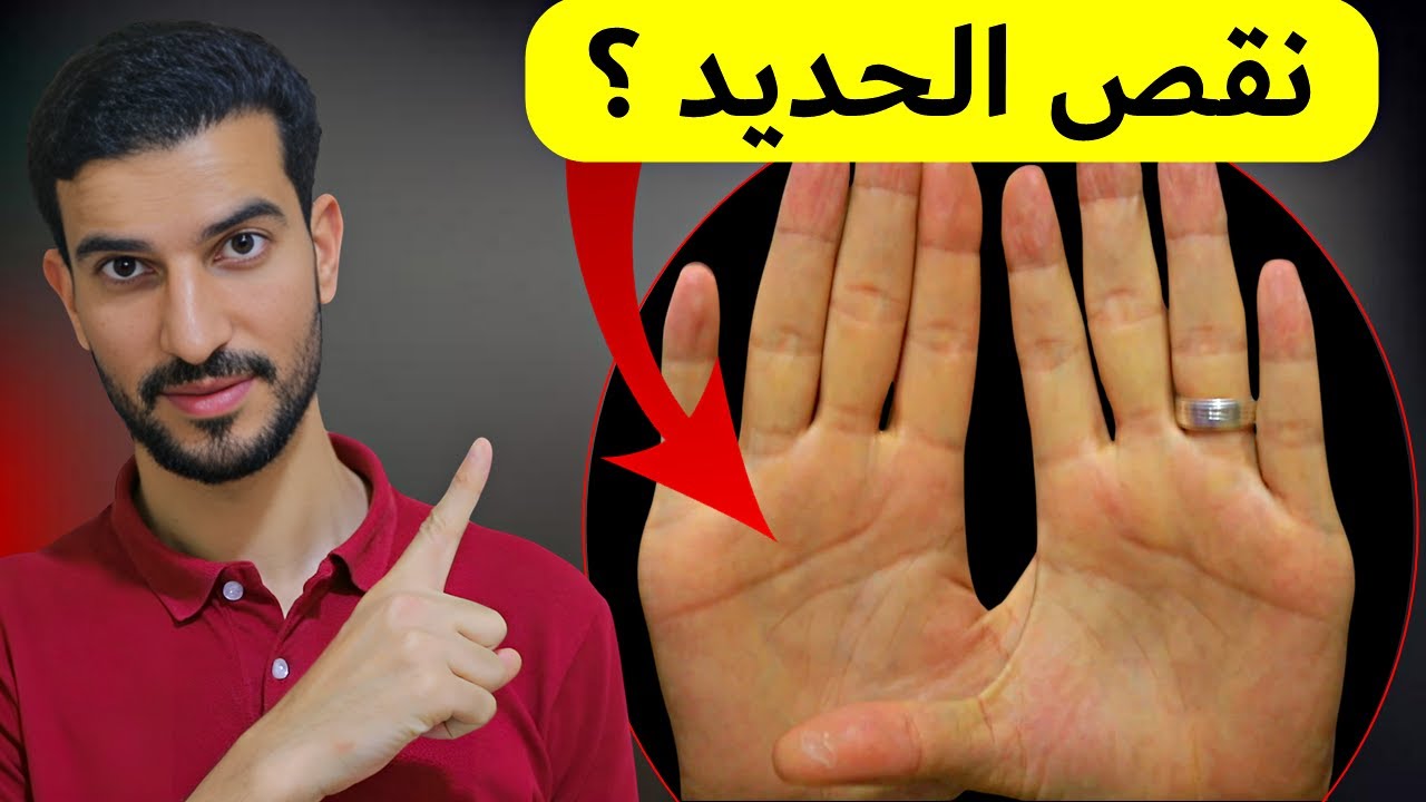 هل عندك أنيميا؟ 10علامات تحذيرية | د. احمد الخطيب