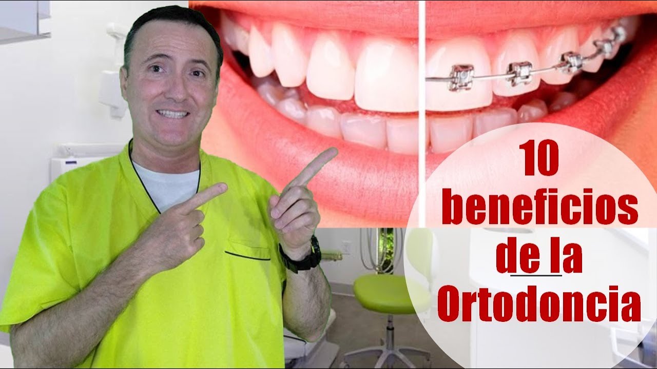 10 Beneficios de la Ortodoncia