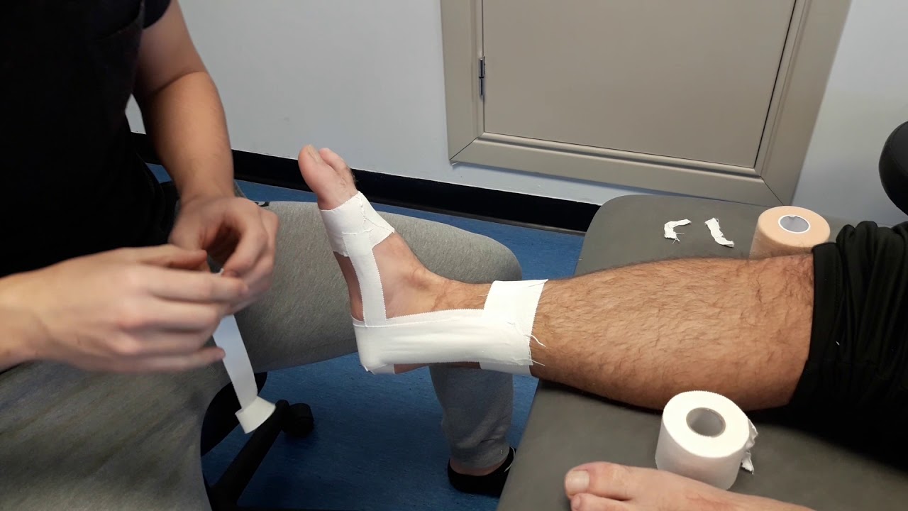 Vendaje funcional para el ligamento deltoideo del tobillo