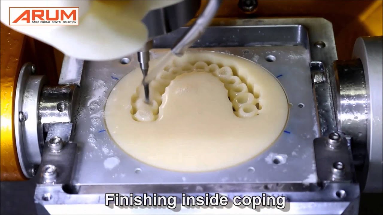 [Dental CNC] PMMA Temporary Bridge