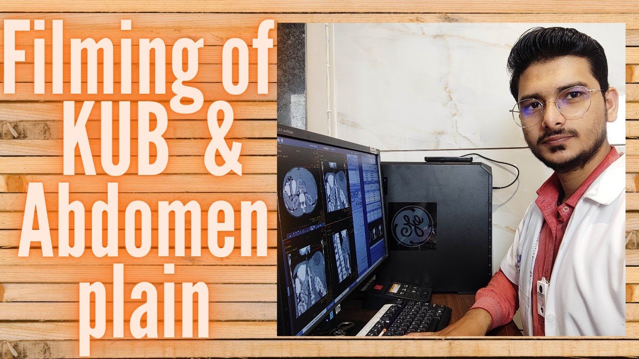 CT SCAN KUB and ABDOMEN PELVIS Plain Filming Process & Techniques on GE machine #radiology