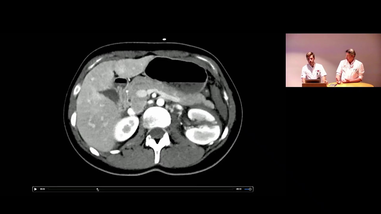 Polikliniek radiologie #5 CT abdomen labyrinth