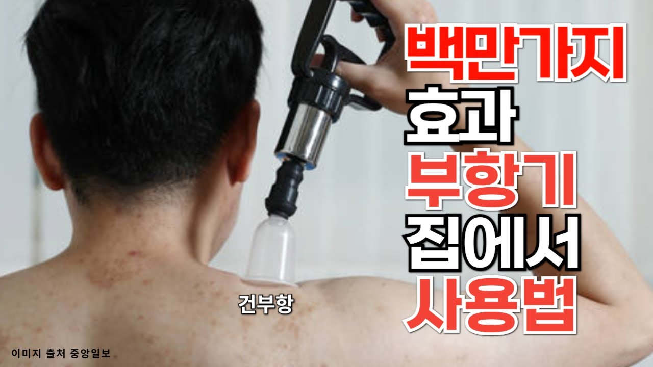 (유료광고 포함)효과 만점 집에서 부항기 사용법 ㅣ부항은 꼭 집에 마련해 두고 수시로 사용하면 아주 좋습니다 ㅣ 부항 치료 원리와 주의할 점 #부항사용법 #부항효과
