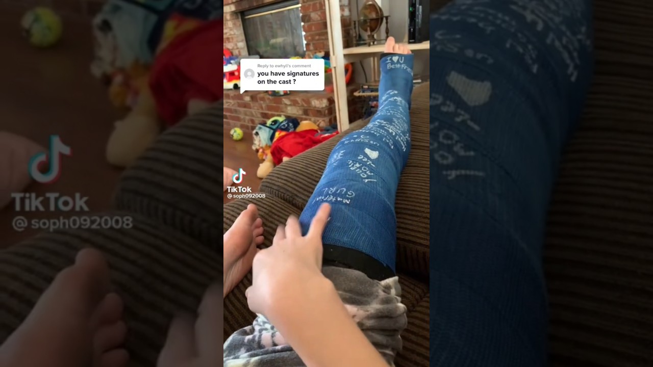 #escayola #fractura #yeso #chica #csstfetish