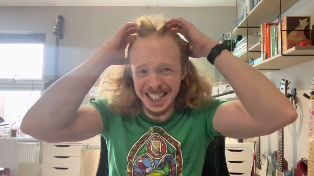 From fine to panic to hair transplant - FUE diary day 2!