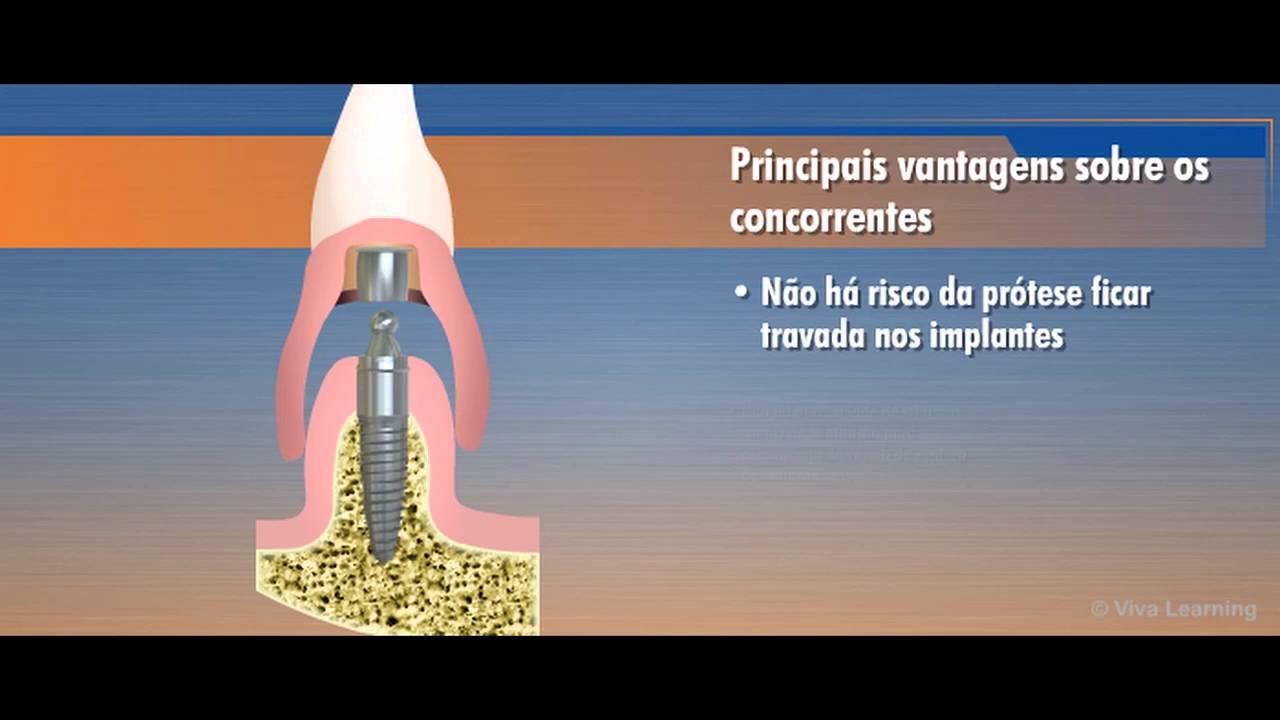 Quick Up | VOCO do Brasil