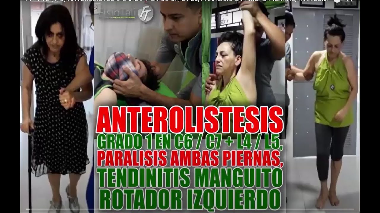 1 PARTE (1/3) ANTEROLISTESIS GRADO 1 EN C6-C7, L4-L5, PARALISIS EN AMBAS PIERNAS, MANGUITO ROTADOR.