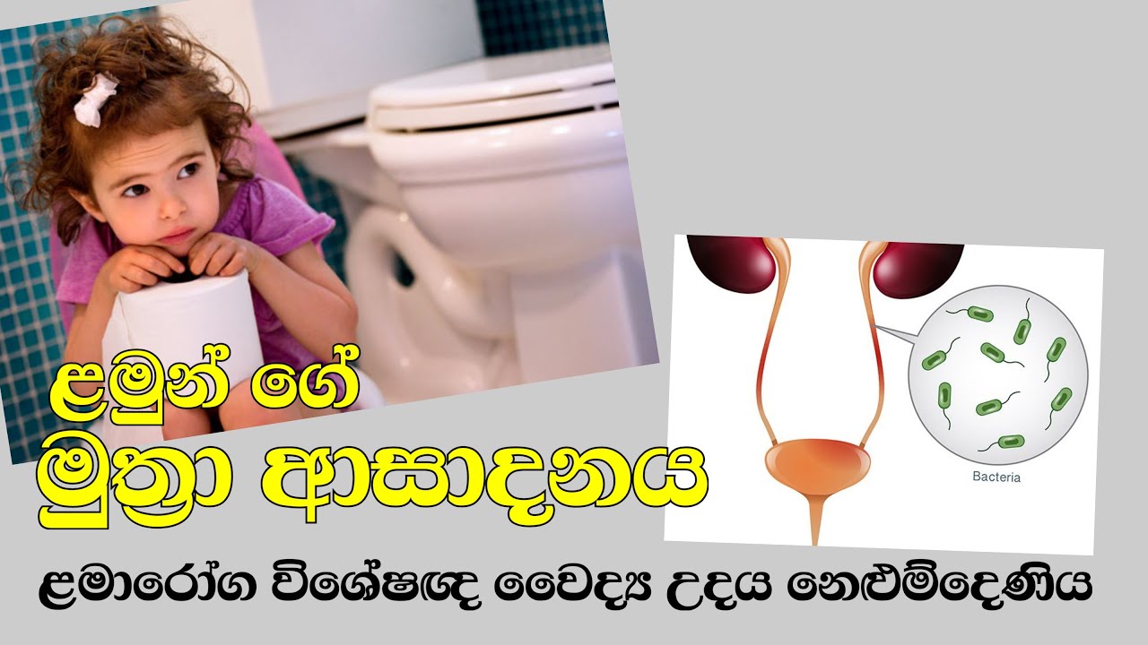 ළමා මුත්‍රා ආසාදනය - Child Specialist by Udaya Nelumdeniya