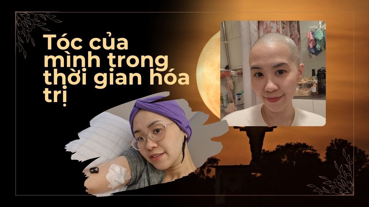 Hành trình ung thư- Chuyện tóc tai