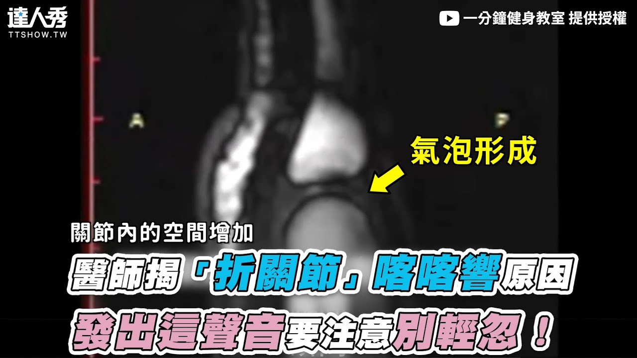 【醫師揭「折關節」喀喀響原因 發出這聲音要注意別輕忽！】｜@1minutefitness
