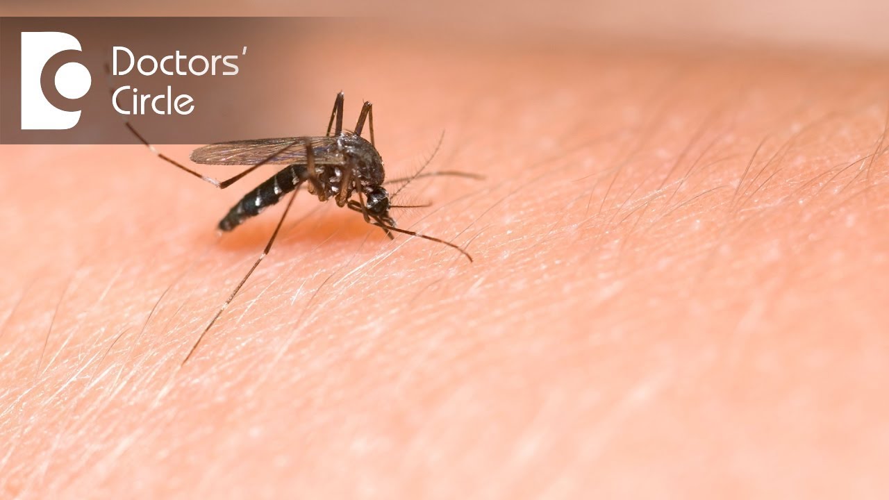 Is it possible to treat high allergy levels after mosquito bite? - Dr. Sanjay Panicker