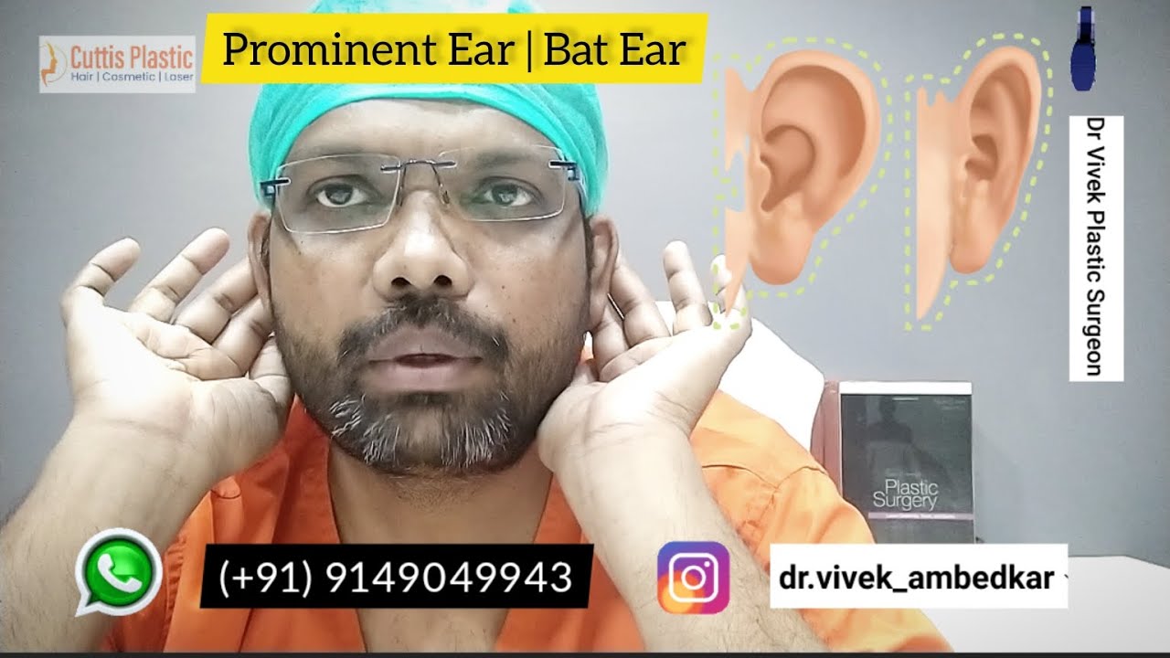 Prominent Ear | Bat Ear | Otoplasty Surgery | Ear Surgery