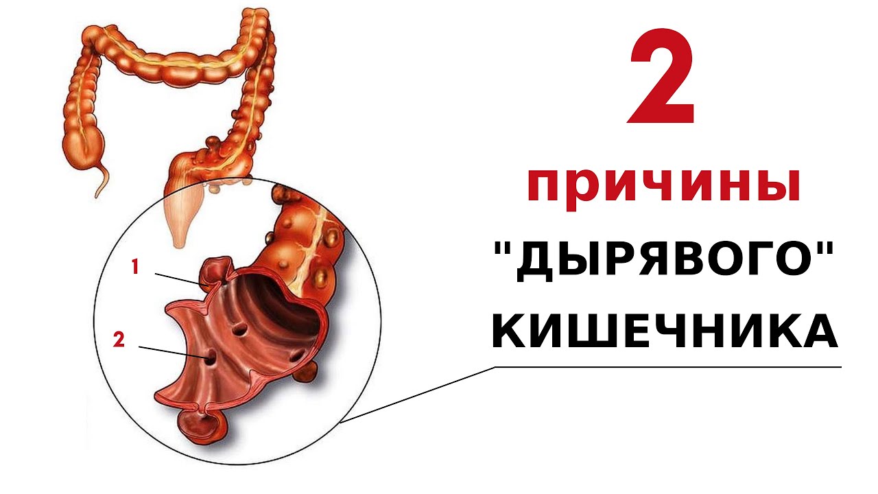 Как определить любителя анального секса / Почему появляются дырки в кишечнике