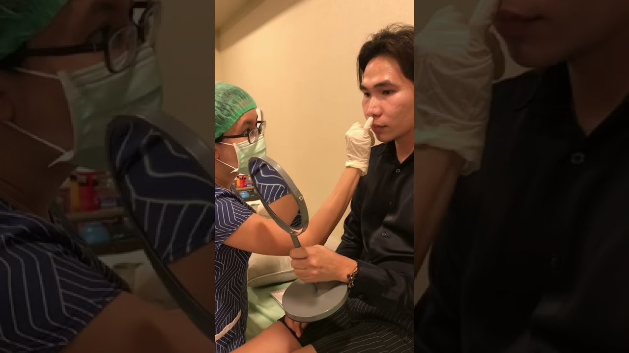My Rhinoplasty Journey in Thailand