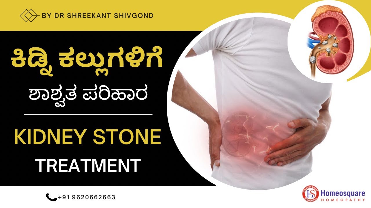 ಕಿಡ್ನಿ ಕಲ್ಲುಗಳಿಗೆ ಶಾಶ್ವತ ಪರಿಹಾರ | kidney stone Kannada | Treatment for Kidney stone Kannada