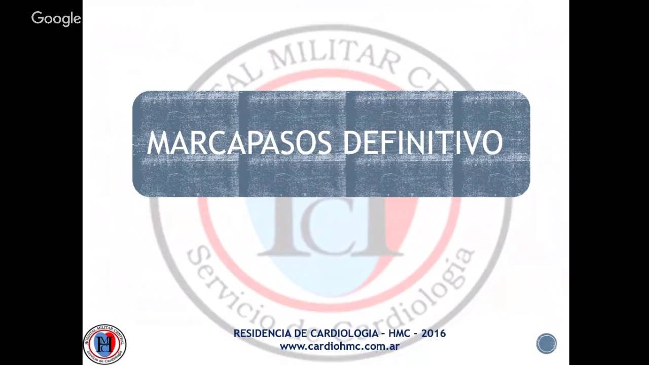 MARCAPASOS