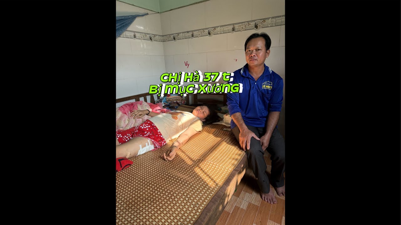 Chị Hà 37 tuổi bị mục xương 2 chân dập nát 6 chỗ