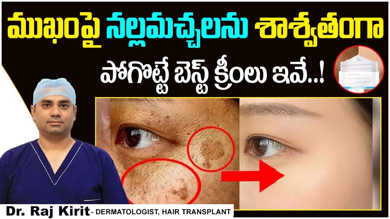 నల్ల మచ్చలకు శాశ్వత పరిష్కారం || Best Cream to Remove Dark spots From Face || Celestee Skin Clinic