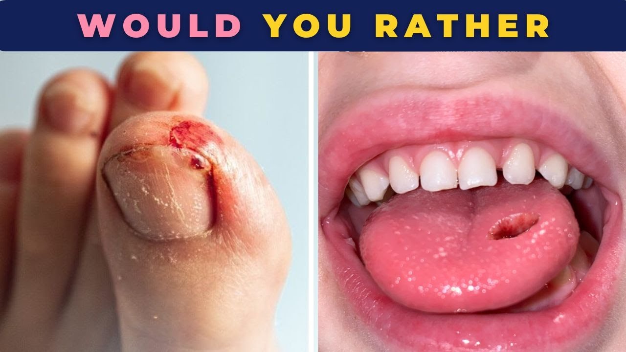 Would you rather 2025 | 50 Hard choices | Quiz Quiz 🥶💪🦷👆💇&zwj;♀️👀😳👅