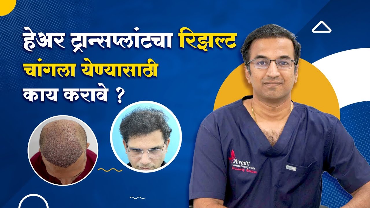 हेअर ट्रान्सप्लांटचा रिझल्ट चांगला येण्यासाठी काय करावे ? | By - Dr. Neeraj Bhaban