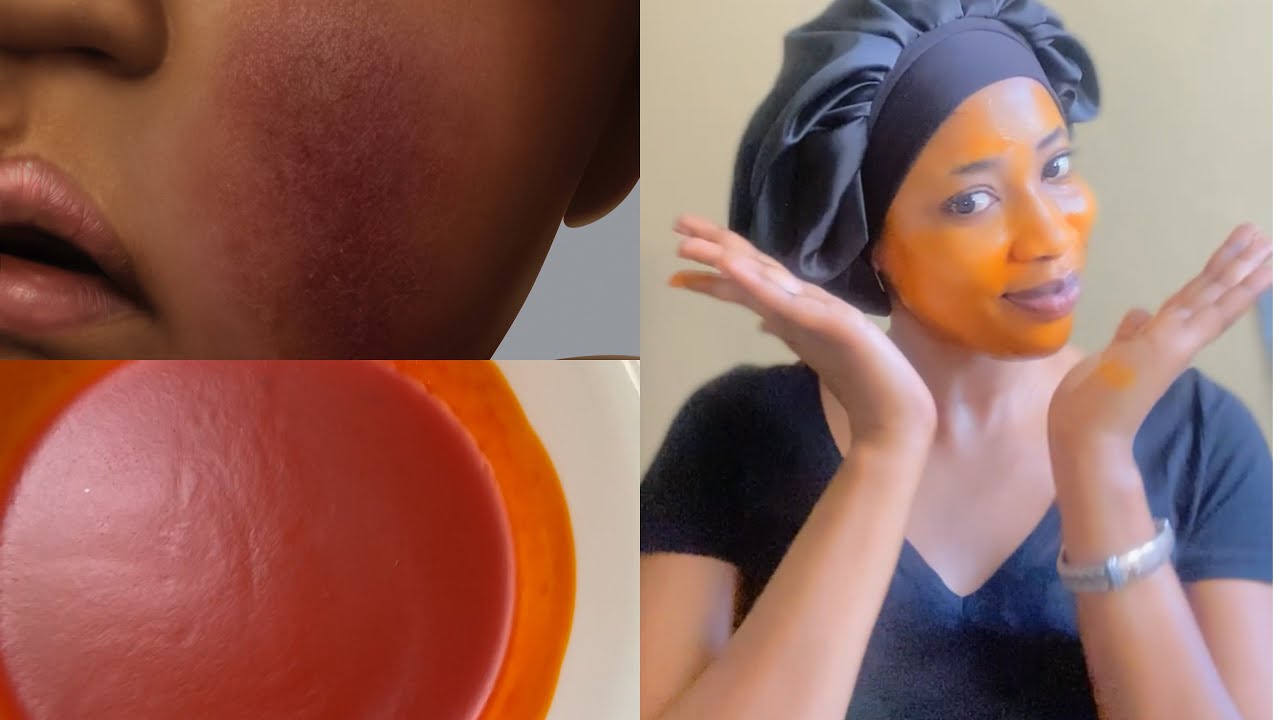 ASTUCE contre les rougeurs du visage