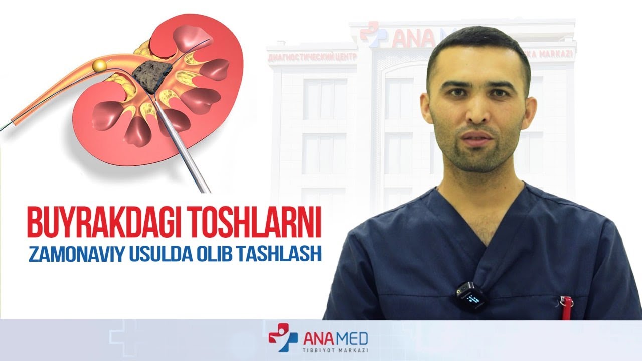 Buyrakdagi toshlarni zamonaviy usulda olib tashlash!