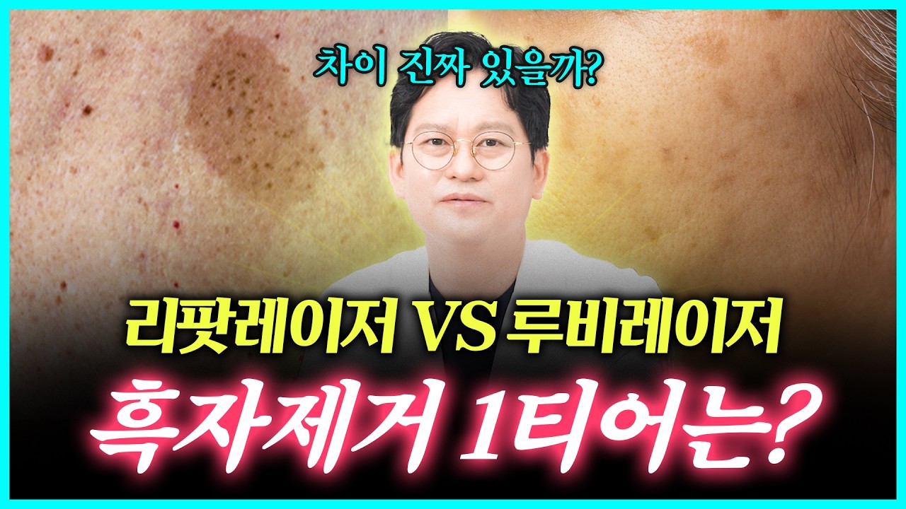 리팟레이저vs루비레이저 흑자치료제거 1티어 공개합니다.