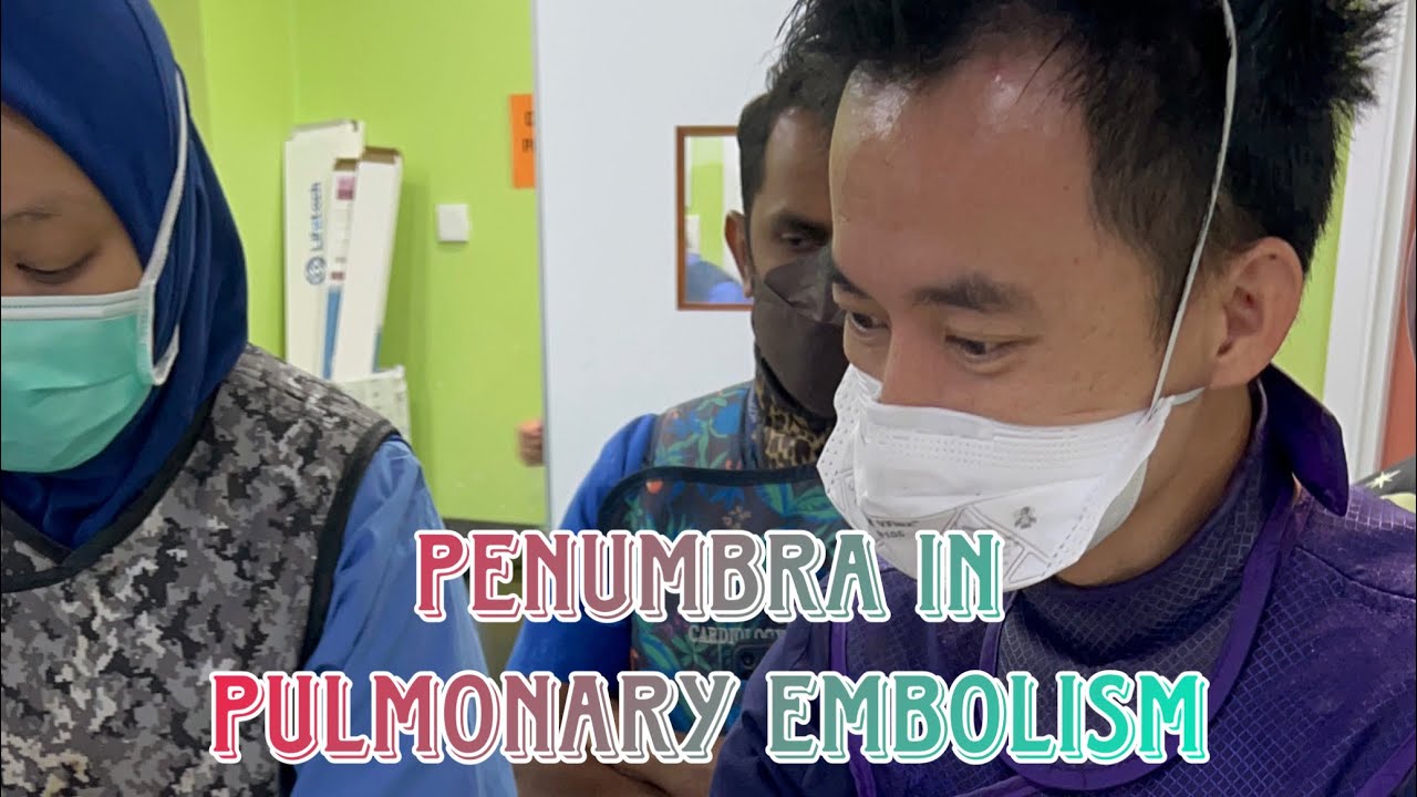 Steps for using Penumbra In Pulmonary Embolism