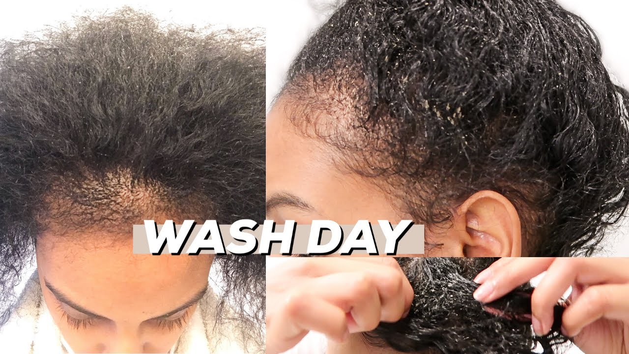 I WENT 1 MONTH WITHOUT WASHING MY HAIR😱 *SHEDDING AND FALLOUT*