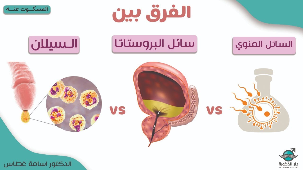 الفرق بين السيلان و سائل البروستاتا و السائل المنوي !المسكوت عنة | الدكتور أسامة غطاس