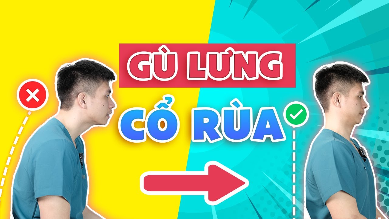 Bài Tập Cải Thiện Tình Trạng Gù Lưng, Cổ Rùa