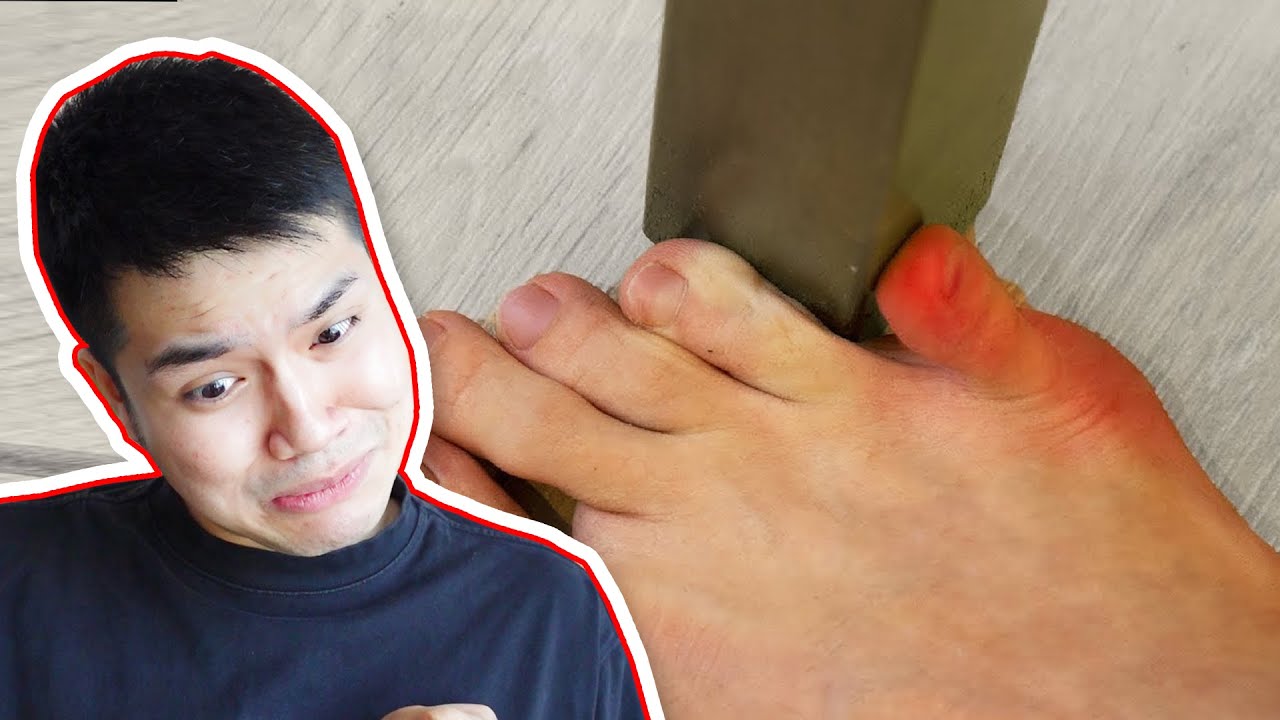 Reaction TẤT CẢ ĐAU CỦA BẠN TRONG MỘT VIDEO | Đức Reaction