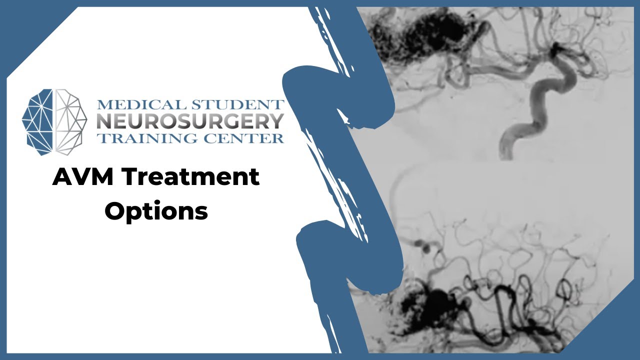 AVM Treatment Options