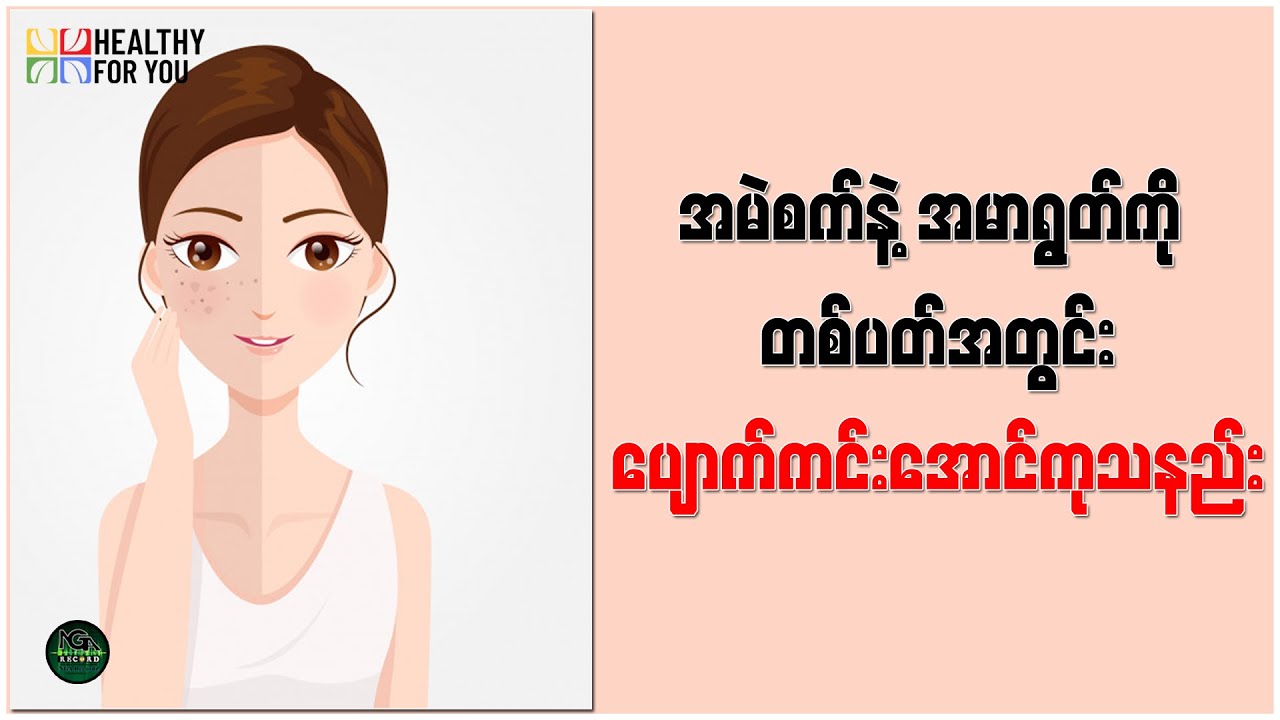 အမဲစက်နဲ့ အမာရွတ်ကိုတစ်ပတ်အတွင်းပျောက်ကင်းအောင်ကုသနည်း ( Healthy For You Myanmar )