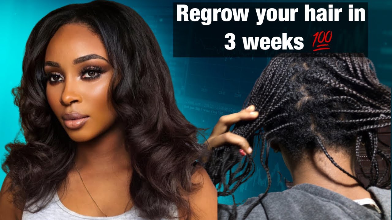 Grow long hair while you sleep✅ Mini braids for massive hair growth and length retention