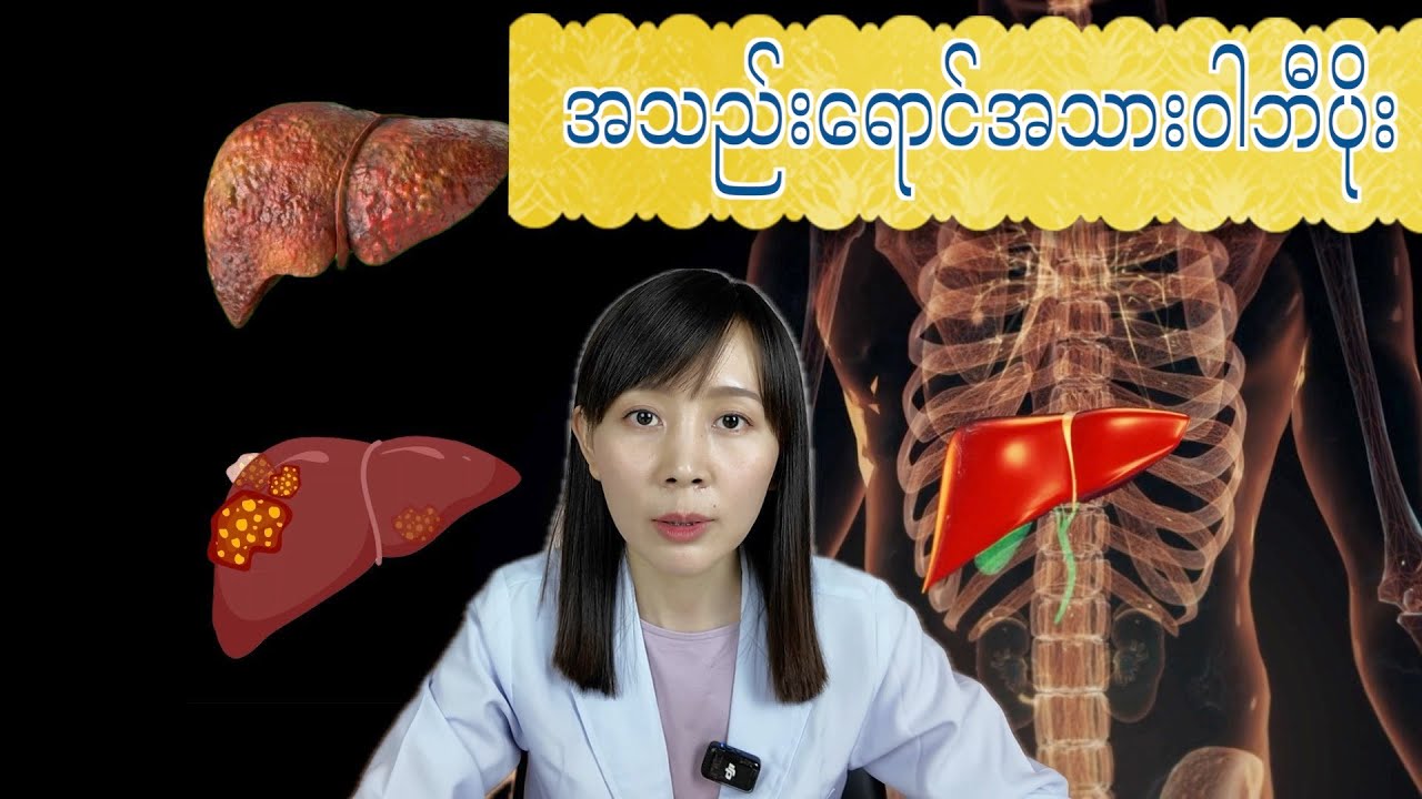 အသည်းရောင်အသားဝါဘီပိုး | Hepatitis B